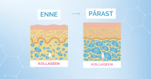 Kõik, mida pead teadma kollageeni toodet valides Ultimate Beauty kollageen nahas